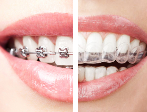 WHEN SHOULD ORTHODONTIC TREATMENT BE STARTED