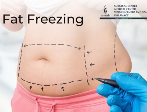 Fat Freezing: Remove Stubborn Fat